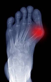 Imagem clínica ilustrativa